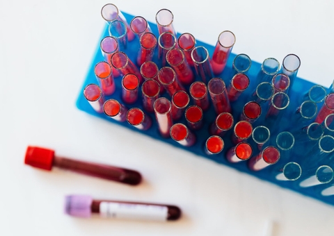 Manaus tem 34 novos casos de covid em 24h e interior do Amazonas chega a 85 testes positivos