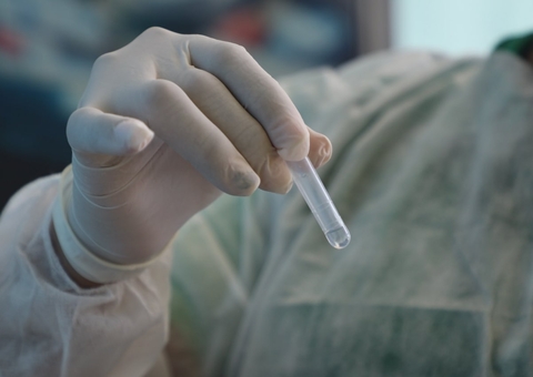 Amazonas tem 50 novos casos registrados de covid e confirma 1 óbito 