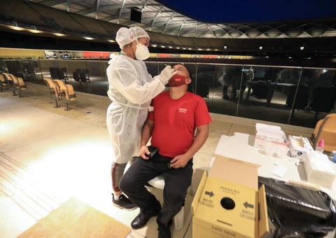 Amazonas registra 2 óbitos e 73 novos casos de covid-19