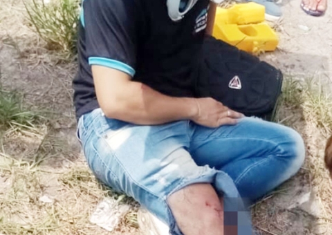 Motociclista tem perna dilacerada durante racha em Manaus