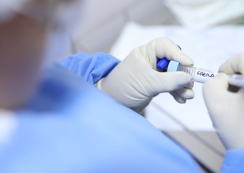 Amazonas registra 412 novos casos e 5 mortes por Covid-19