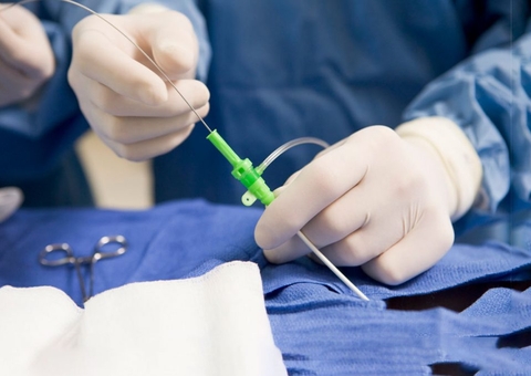 Mulher será indenizada por ficar mais de seis anos com cateter na bexiga