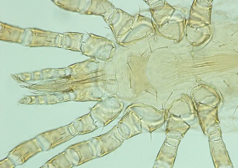 Bebês são transferidos após registro de piolho de pombo em UTI neonatal em Belo Horizonte