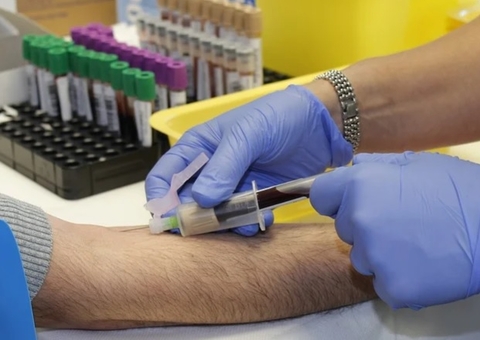 Piso salarial de enfermeiros pode ser incluído na pauta do Senado