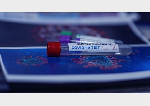 Pelo menos 40 atletas testaram positivo para covid nas Olimpíadas