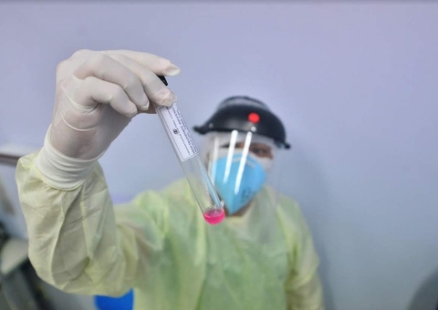 Covid-19: casos chegam a 16,9 milhões e mortes, a 473,4 mil