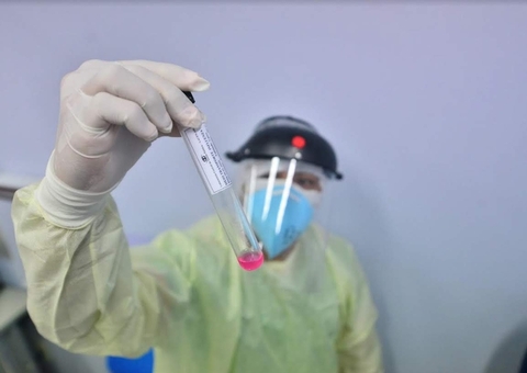 Covid-19: Brasil soma 541,2 mil mortes e vai 19,3 milhões de casos