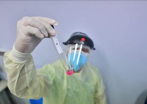 Covid-19: Brasil tem 21 milhões de casos e 587,7 mil mortes