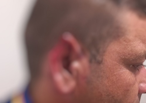 Frentista tem pedaço da orelha arrancada durante briga em posto