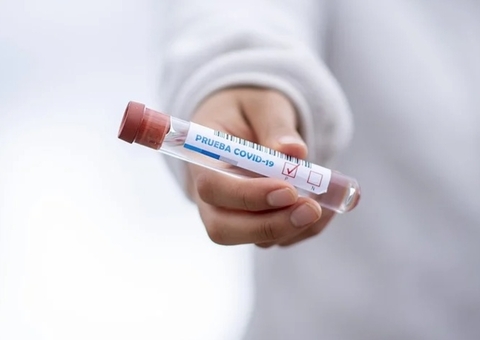 Amazonas registra 47 novos casos de Covid nesta quarta-feira