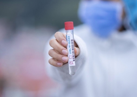 Covid-19: Brasil acumula 30,5 milhões de casos e 663,7 mil óbitos