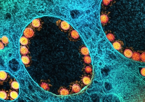 Amazonas tem 74 novos casos e dois óbitos por Covid-19