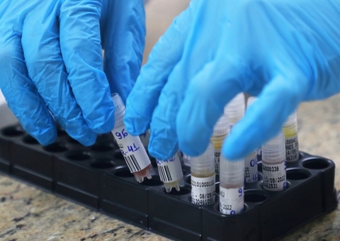 Amazonas ultrapassa 300 casos de varíola dos macacos nesta quarta-feira