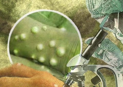 Saúde do Amazonas divulga nota de orientação sobre varíola dos macacos