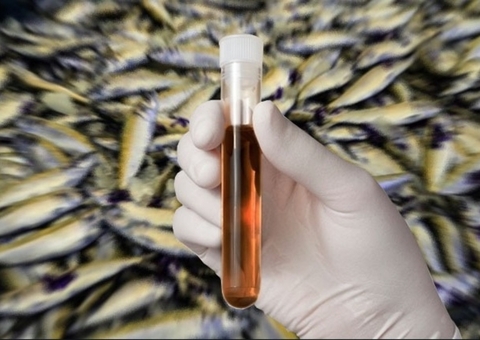 Sobe para 42 o número de casos de Doença da Urina Preta no Amazonas