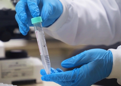 Casos de mpox no Brasil este ano já superam o total de 2023