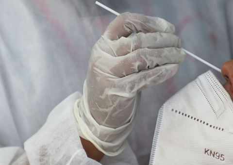 Amazonas registra 124 novos casos de Covid em 24 horas