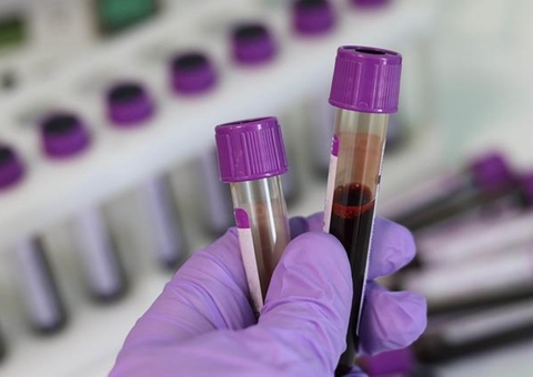 Brasil chega a 37 casos de infecção por varíola dos macacos 