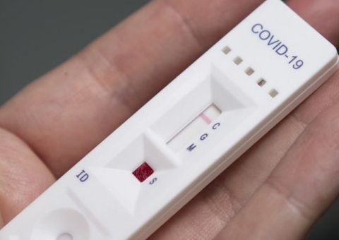 Justiça nega pedido da DPE para testagem em massa no Amazonas