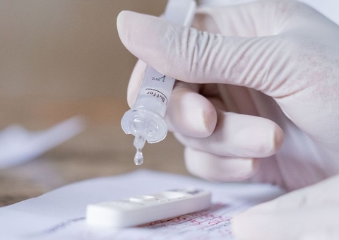 Com 3º dia sem mortes por Covid, Amazonas registra 45 novos casos da doença