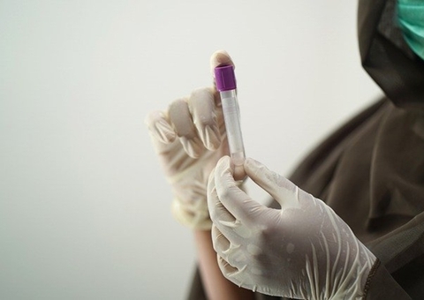 Covid-19 representa 41% dos casos de síndrome respiratória grave