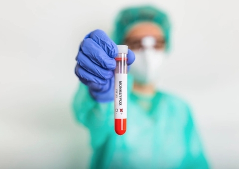 Sobe para 54 o número de infectados pela varíola dos macacos no Amazonas