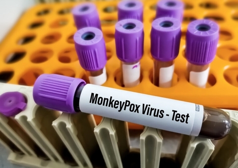 Amazonas não registra novos casos de varíola dos macacos nesta sexta-feira