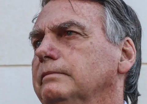 Defesa solicita ao STF que Bolsonaro não volte à PF após alta hospitalar