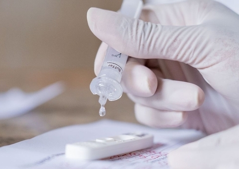 Sem mortes, Amazonas registra 31 novos casos de Covid em 24h