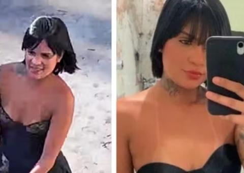 Mulher arrastada por carro passa por nova cirurgia após amputação das pernas