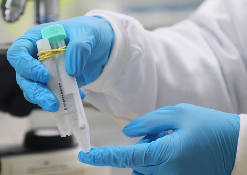 Amazonas tem 3 novos casos suspeitos de varíola dos macacos