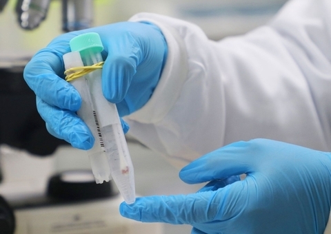 Sobe para 292 o número de infectados pela varíola dos macacos no Amazonas