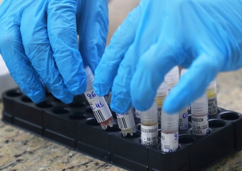 Amazonas não registra novos casos de varíola dos macacos nesta sexta-feira