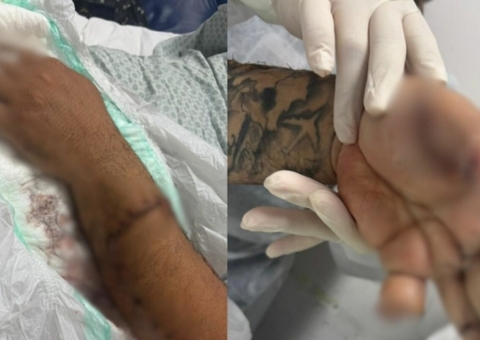 Passageiro é preso em Manaus após atacar motorista de APP com terçado e pitbulls