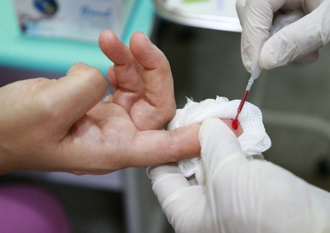 Casos de hepatite infantil misteriosa sobem para 47 no Brasil