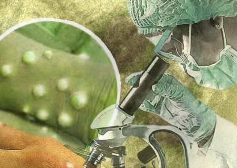 Amazonas tem 77 casos suspeitos de varíola dos macacos