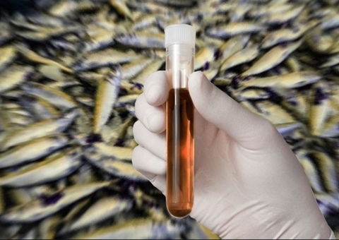 Com 124 notificações, Amazonas tem 118 casos de Doença da Urina Preta