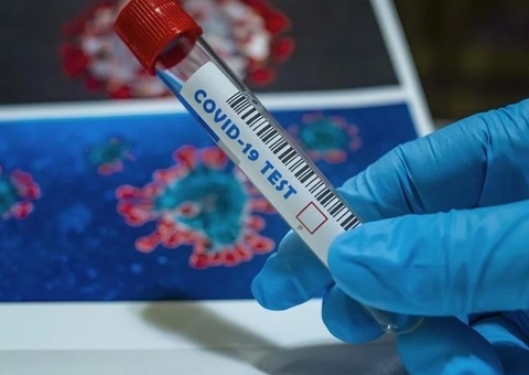 Amazonas não registra novas mortes por Covid nas últimas 24h; casos são 13