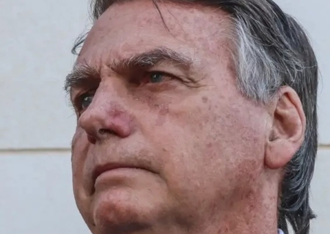 Bolsonaro faz exames na cabeça após queda em cela da PF, em Brasília