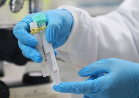 Amazonas não registra novos casos de varíola dos macacos nesta quinta-feira