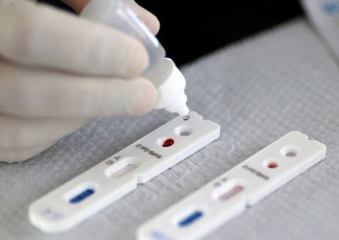 Amazonas registra 10 novos casos e uma morte por covid em 24h