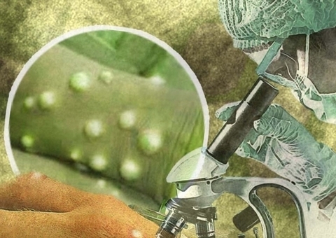 Varíola dos macacos: OMS diz para homens que fazem sexo com homens reduzirem parceiros