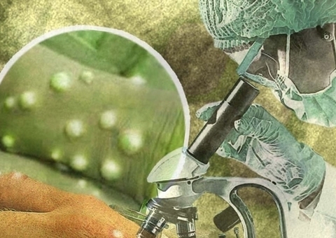 Varíola dos macacos: calendário de vacinação deve sair nesta semana