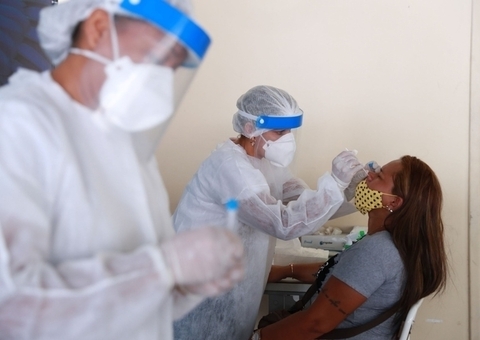 Em 24h, Amazonas registra 149 novos casos de Covid