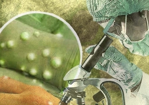 Amazonas confirma mais 5 infectados pela varíola dos macacos; total chega a 265