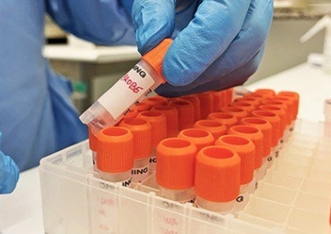 OMS alerta sobre avanço da varíola dos macacos no Brasil: 'muito preocupante'