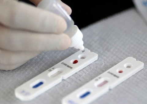 Sem mortes, Amazonas registra 27 novos casos de Covid-19 em 24h