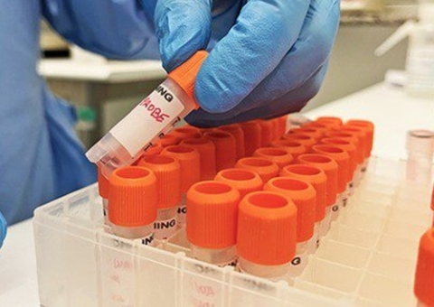 Brasil chega a 6 casos confirmados de infecção por varíola dos macacos