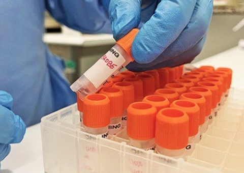 Amazonas descarta 2 casos suspeitos de varíola dos macacos; um paciente é monitorado