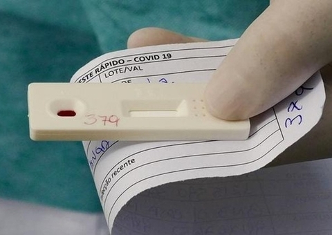 Liberação da venda do autoteste de Covid-19 será decidida nesta sexta